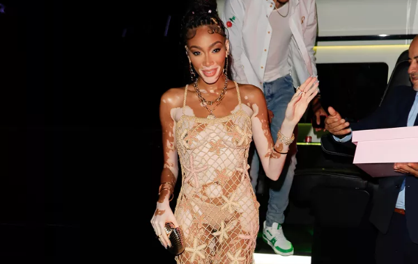 Winnie Harlow Stuns in Undersea Glam: Embracing the Mermaidcore Trend